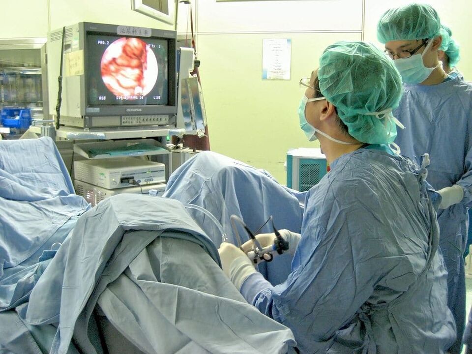 traitement chirurgical des calculs de la prostatite