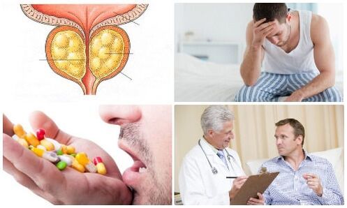 prostatite chez les hommes